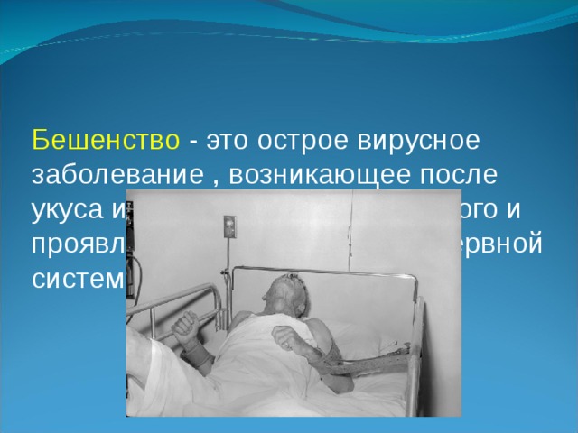 Бешенство - это острое вирусное заболевание , возникающее после укуса инфицированного животного и проявляющееся поражением нервной системы 