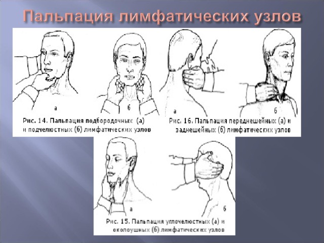 Пальпация жевательных мышц в стоматологии презентация - 94 фото