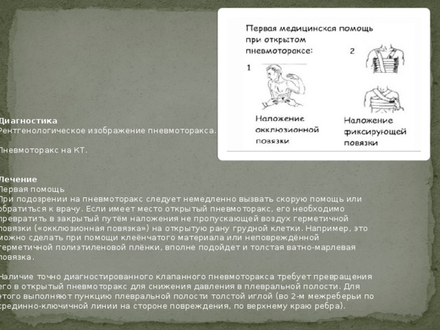 Пневмоторакс карта вызова скорой