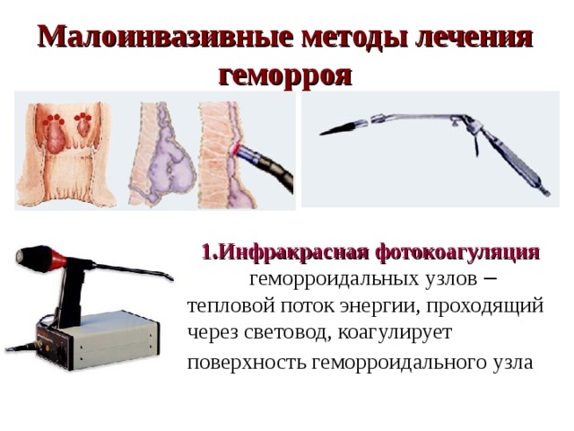 Кровотечение из геморроидальных узлов карта вызова скорой помощи