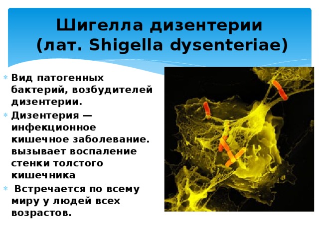 Шигелла дизентерии  (лат. Shigella dysenteriae) Вид патогенных бактерий, возбудителей дизентерии. Дизентерия — инфекционное кишечное заболевание. вызывает воспаление стенки толстого кишечника  Встречается по всему миру у людей всех возрастов. 
