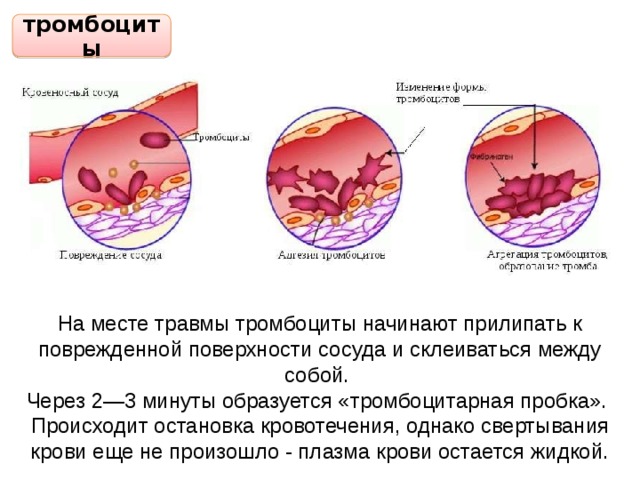 Тромбоциты при кровотечении. Тромбоциты процесс свертывания крови. Тромбоциты повреждение сосуда схема. Тромбоциты образование тромба. Тромбоциты останавливают кровотечение.