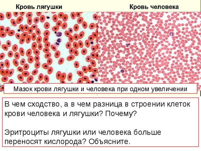 Мазок крови лягушки и человека при одном увеличении В чем сходство, а в чем разница в строении клеток крови человека и лягушки? Почему? Эритроциты лягушки или человека больше переносят кислорода? Объясните. 