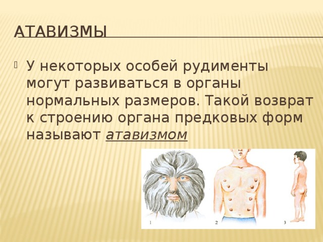 Рудименты и атавизмы животных презентация