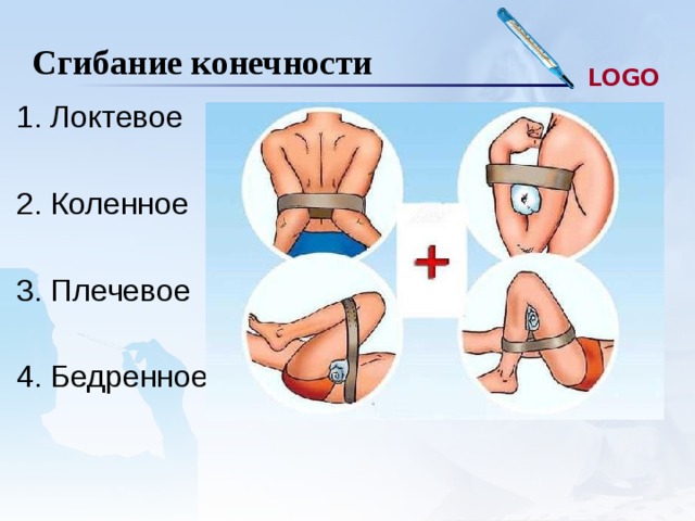 Максимальное сгибание конечности. Максимальное сгибание конечности при кровотечении. Максимальное сгибание конечности в суставе. Максимальное гибаниеконечности в сутсве. Форсированное сгиьание конечносности.