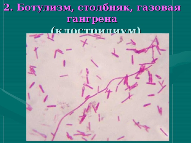 2. Ботулизм, столбняк, газовая гангрена  (клостридиум) 