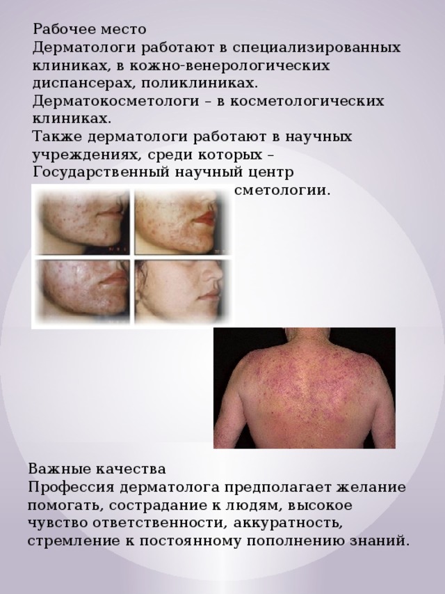 Рабочее место Дерматологи работают в специализированных клиниках, в кожно-венерологических диспансерах, поликлиниках. Дерматокосметологи – в косметологических клиниках.  Также дерматологи работают в научных учреждениях, среди которых – Государственный научный центр дерматовенерологии и косметологии.   Важные качества Профессия дерматолога предполагает желание помогать, сострадание к людям, высокое чувство ответственности, аккуратность, стремление к постоянному пополнению знаний.   