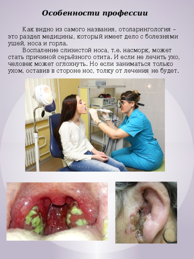 Особенности профессии   Как видно из самого названия, отоларингология – это раздел медицины, который имеет дело с болезнями ушей, носа и горла.  Воспаление слизистой носа, т.е. насморк, может стать причиной серьёзного отита. И если не лечить ухо, человек может оглохнуть. Но если заниматься только ухом, оставив в стороне нос, толку от лечения не будет. 