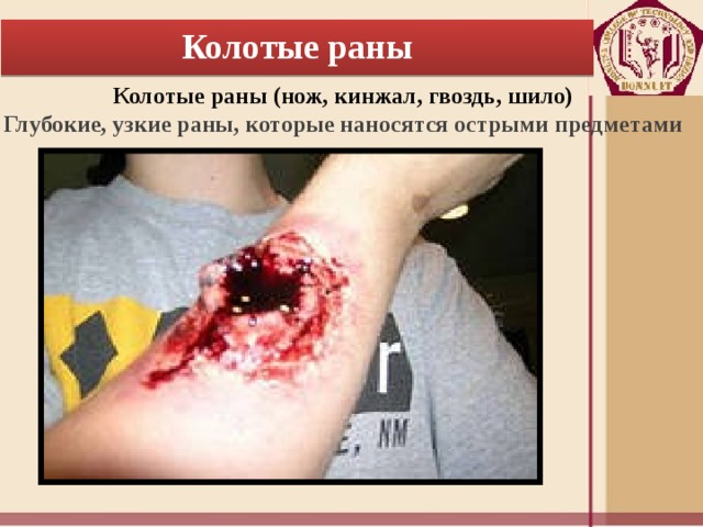 Колотые раны Колотые раны (нож, кинжал, гвоздь, шило) Глубокие, узкие раны, которые наносятся острыми предметами 