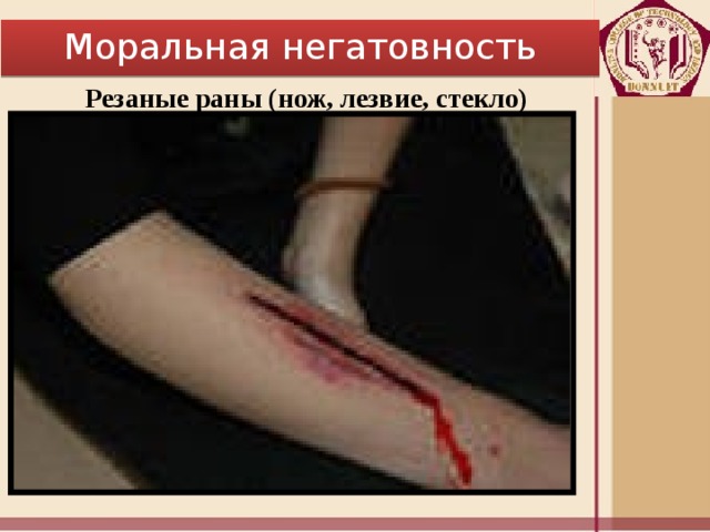 Моральная негатовность Резаные раны (нож, лезвие, стекло) 