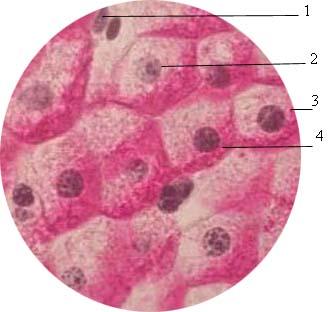 Гликоген в клетках печени. Включения гликогена в клетках печени аксолотля. Клетки печень акцолотки. Включения гликогена препарат гистология. Интерфазное ядро клетки печени аксолотля.