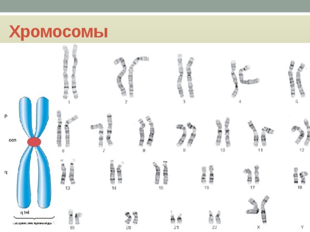 Хромосомы 