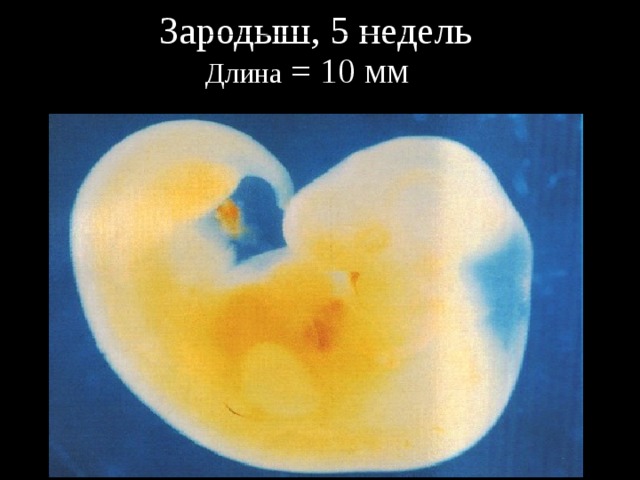 Зародыш, 5 недель Длина = 10 мм 