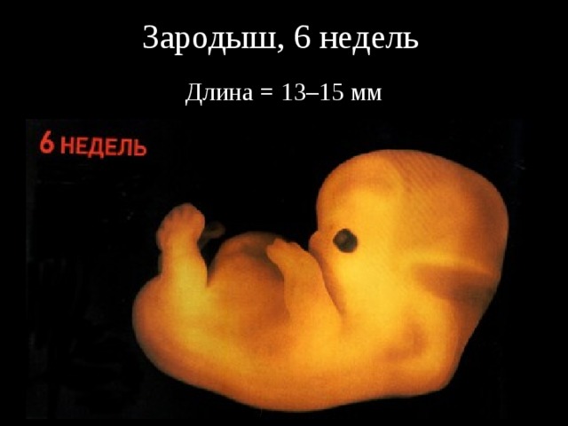 Зародыш, 6 недель Длина = 13–15 мм 