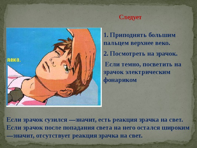 Следует 1. Приподнять большим пальцем верхнее веко. 2. Посмотреть на зрачок.  Если темно, посветить на зрачок электрическим фонариком  Если зрачок сузился —значит, есть реакция зрачка на свет. Если зрачок после попадания света на него остался широким—значит, отсутствует реакция зрачка на свет. 