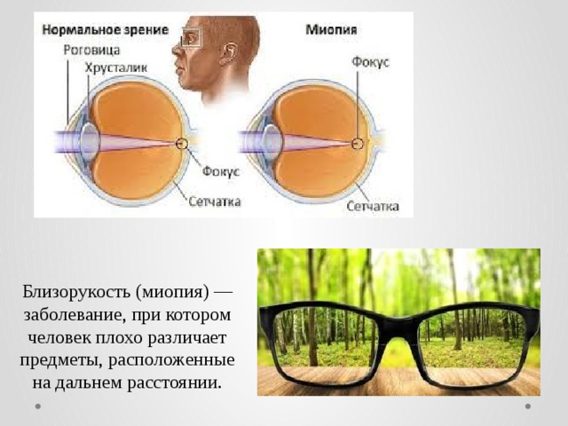 Расплывчатое изображение близкорасположенных предметов