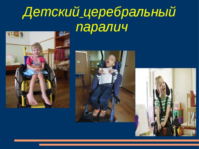 Презентация на тему дцп