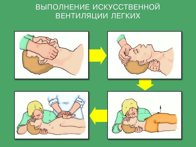 Презентация на тему непрямой массаж сердца