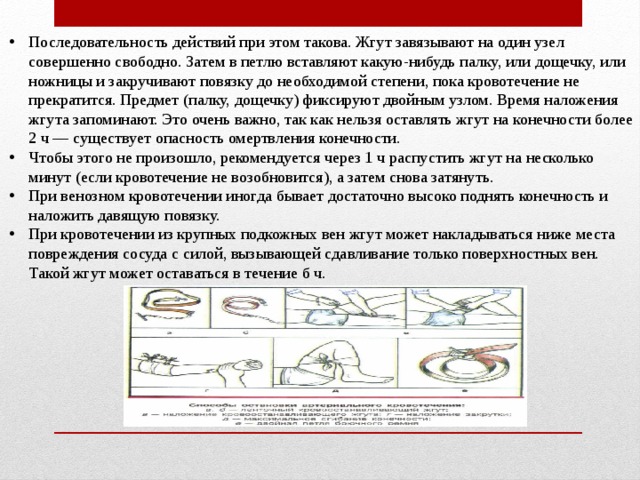 Последовательность действий при венозном кровотечении