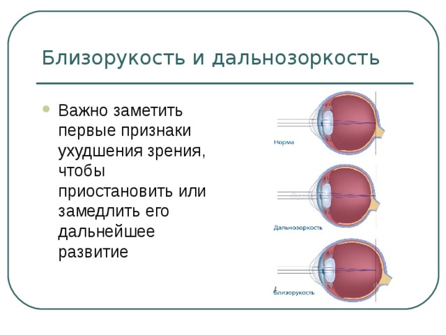 Рассмотрите рисунок сравните близорукость и дальнозоркость ответы занесите в таблицу