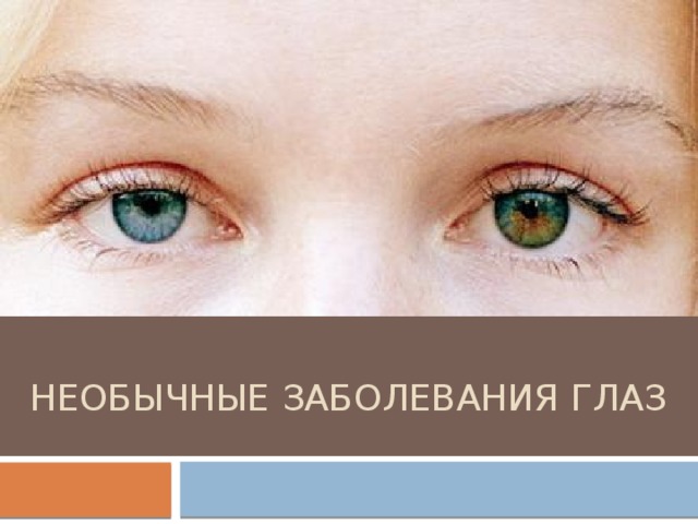 Необычные Заболевания глаз 