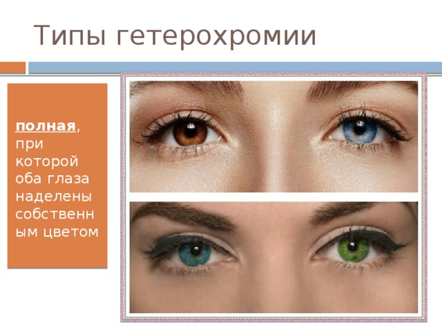 Типы гетерохромии полная , при которой оба глаза наделены собственным цветом 