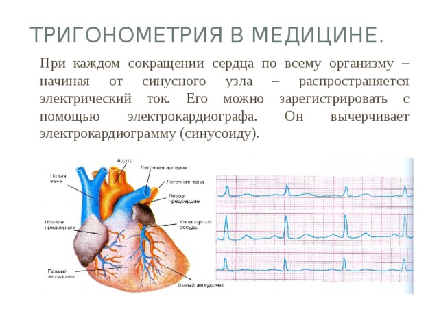 ТРИГОНОМЕТРИЯ в медицине.  При каждом сокращении сердца по всему организму – начиная от синусного узла – распространяется электрический ток. Его можно зарегистрировать с помощью электрокардиографа. Он вычерчивает электрокардиограмму (синусоиду).  