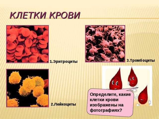 Клетки крови  1.Эритроциты  3.Тромбоциты Определите, какие клетки крови изображены на фотографиях?  2.Лейкоциты 