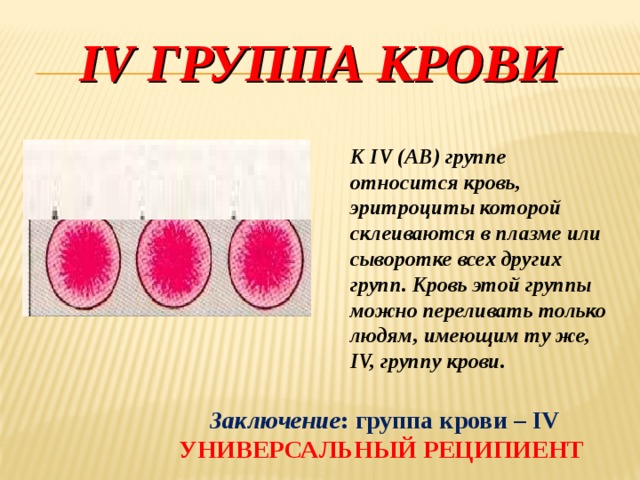 IV группа крови  К IV (АВ) группе относится кровь, эритроциты которой склеиваются в плазме или сыворотке всех других групп. Кровь этой группы можно переливать только людям, имеющим ту же, IV, группу крови. Заключение : группа крови – IV УНИВЕРСАЛЬНЫЙ РЕЦИПИЕНТ  