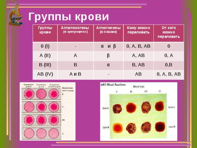 Группы крови Группы крови Аглютиногены 0 (I) (в эритроцитах) Аглютинины - А (II) (в плазме) Кому можно переливать α и β В (III) A AB (IV) B β 0, А, В, АВ От кого можно переливать А, АВ 0 α A и B 0, А В, АВ - 0,В АВ 0, А, В, АВ 