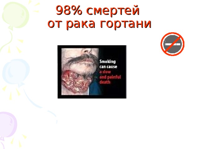 98% смертей  от рака гортани 