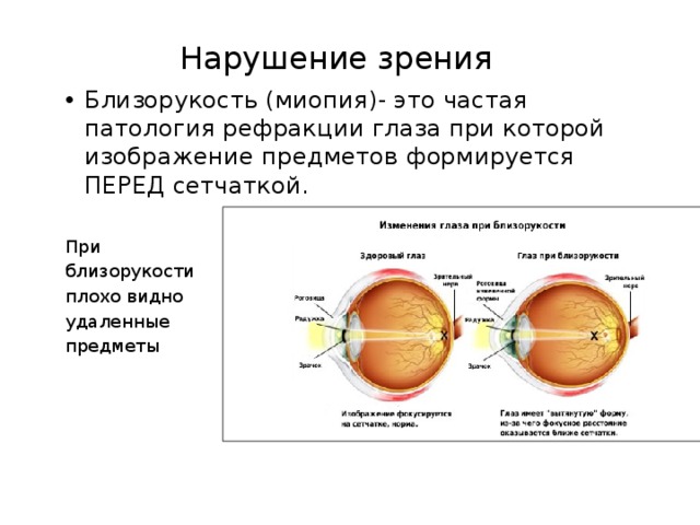 Зрительный анализатор Зрительная  зона коры Зрительный нерв  Зрительный анализатор состоит из трех частей: рецепторы сетчатки глаза, зрительный нерв, зрительная зона коры больших полушарий головного мозга. рецепторы сетчатки глаза, зрительный нерв, зрительная зона коры больших полушарий головного мозга. Рецепторы сетчатки 