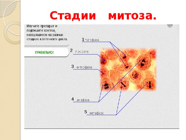 Какая стадия митоза изображена на рисунке