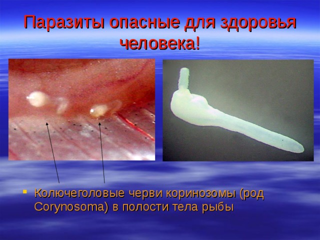 Паразиты опасные для здоровья человека! Колючеголовые черви коринозомы (род Corynosoma) в полости тела рыбы 