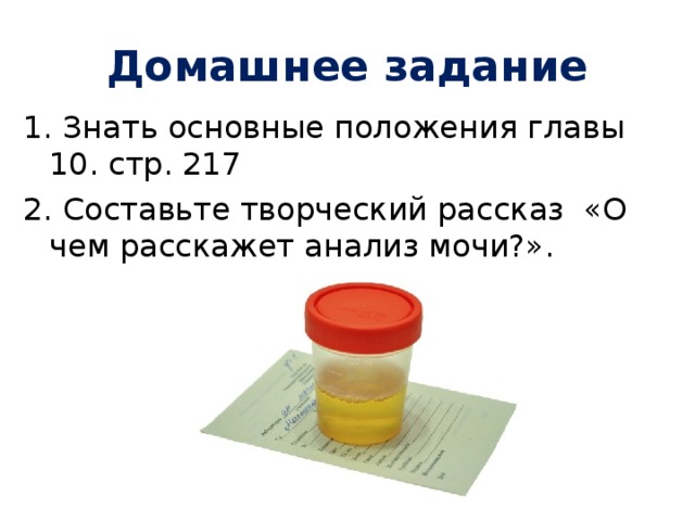 Домашнее задание 1. Знать основные положения главы 10. стр. 217 2. Составьте творческий рассказ «О чем расскажет анализ мочи?».    