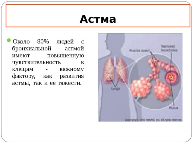Астма Около 80% людей с бронхиальной астмой имеют повышенную чувствительность к клещам - важному фактору, как развития астмы, так и ее тяжести.    12 12 