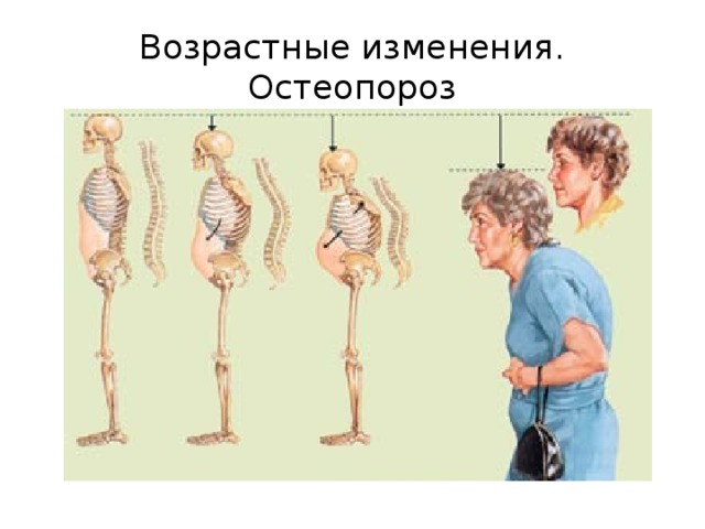 Рассмотрите рисунок иллюстрирующий проявление возрастных изменений человека как