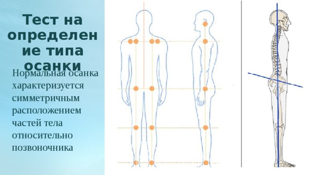 Тестовая карта для выявления нарушений осанки