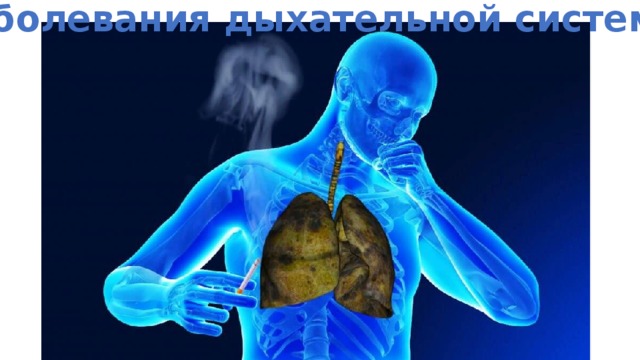 Заболевания дыхательной системы 