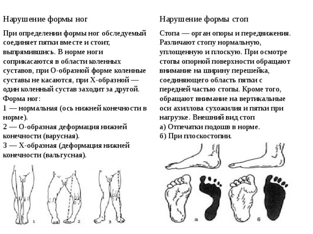 Нарушение формы ног    Нарушение формы стоп     При определении формы ног обследуемый соединяет пятки вместе и стоит, выпрямившись. В норме ноги соприкасаются в области коленных суставов, при О-образной форме коленные суставы не касаются, при Х-образной — один коленный сустав заходит за другой. Форма ног: Стопа — орган опоры и передвижения. Различают стопу нормальную, уплощенную и плоскую. При осмотре стопы опорной поверхности обращают внимание на ширину перешейка, соединяющего область пятки с передней частью стопы. Кроме того, обращают внимание на вертикальные оси ахиллова сухожилия и пятки при нагрузке. Внешний вид стоп 1 — нормальная (ось нижней конечности в норме). а) Отпечатки подошв в норме. 2 — О-образная деформация нижней конечности (варусная). б) При плоскостопии.   3 — Х-образная (деформация нижней конечности (вальгусная). 