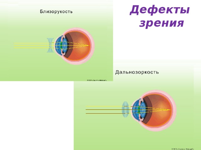 Глаз и зрение близорукость и дальнозоркость физика 8 класс презентация