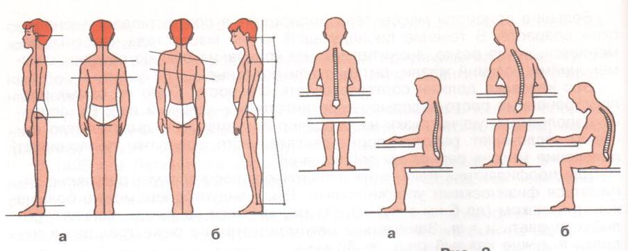 Положение стоящего тела человека. Правильная и неправильная осанка. Правильная осанка вид сбоку. Неправильная осанка вид сбоку. Правильная осанка и сколиоз.