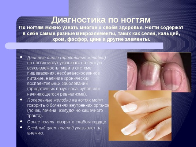 Диагностика по ногтям  По ногтям можно узнать многое о своём здоровье. Ногти содержат в себе самые разные микроэлементы, таких как селен, кальций, хром, фосфор, цинк и другие элементы. Длинные линии (продольные желобки) на ногтях могут указывать на плохую всасываемость пищи в системе пищеварения, несбалансированное питание, наличие хронических воспалительных заболеваний (придаточных пазух носа, зубов или начинающегося ревматизма). Поперечные желобки на ногтях могут говорить о болезнях внутренних органов (почек, печени, желудочно-кишечного тракта). Синие ногти говорят о слабом сердце. Бледный цвет ногтей указывает на анемию. 