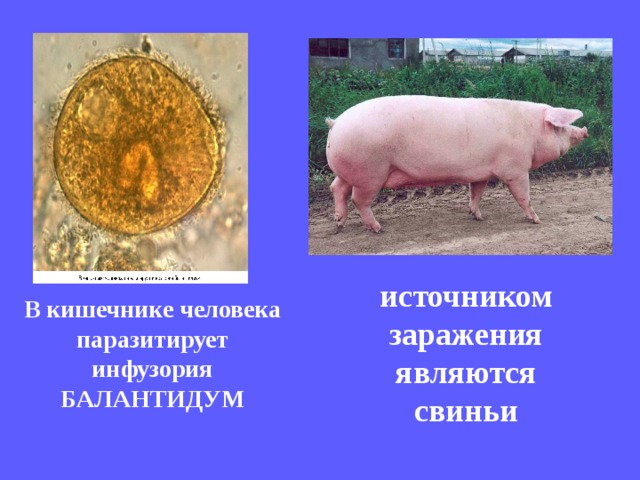источником заражения являются свиньи В кишечнике человека паразитирует инфузория БАЛАНТИДУМ   