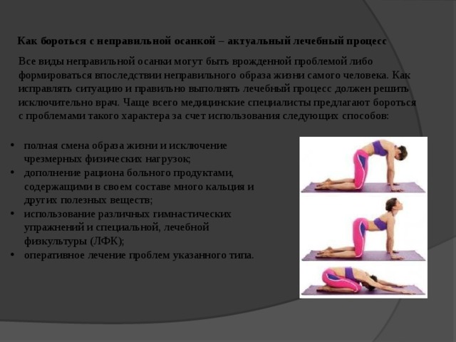 Как бороться с неправильной осанкой – актуальный лечебный процесс Все виды неправильной осанки могут быть врожденной проблемой либо формироваться впоследствии неправильного образа жизни самого человека. Как исправлять ситуацию и правильно выполнять лечебный процесс должен решить исключительно врач. Чаще всего медицинские специалисты предлагают бороться с проблемами такого характера за счет использования следующих способов: полная смена образа жизни и исключение чрезмерных физических нагрузок; дополнение рациона больного продуктами, содержащими в своем составе много кальция и других полезных веществ; использование различных гимнастических упражнений и специальной, лечебной физкультуры (ЛФК); оперативное лечение проблем указанного типа. 