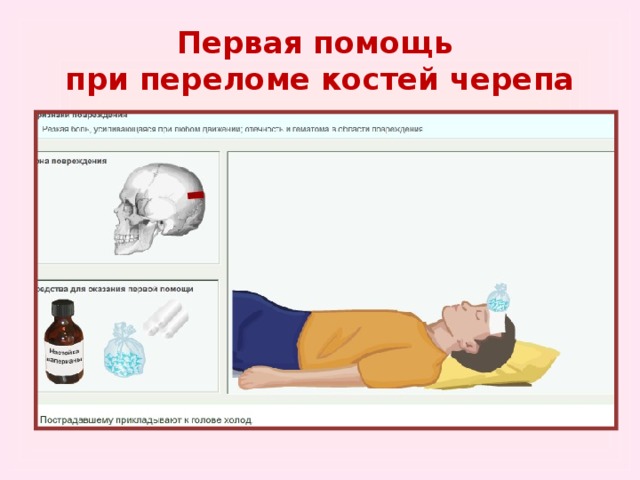 Первая помощь при повреждении скелета