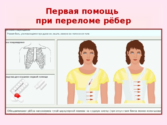 Перелом ребер карта вызова скорой помощи