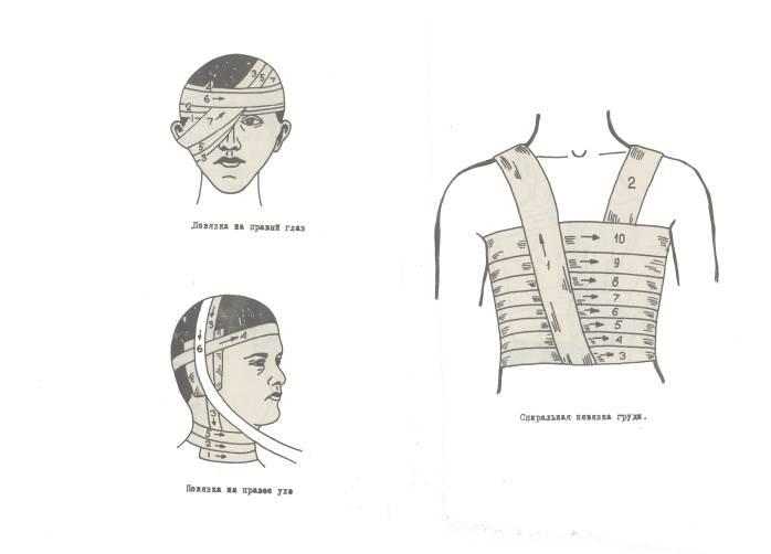 Схема классификации повязок