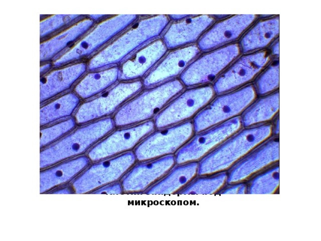 Клетки эпидермы под микроскопом. 