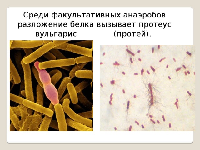 Признаки гнилостных бактерий